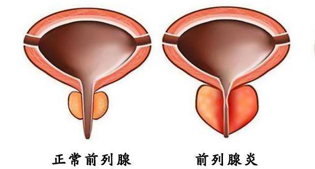 儿童腺病毒的症状及表现概述