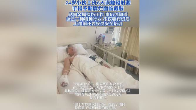 24岁小伙误触辐射源面临截肢