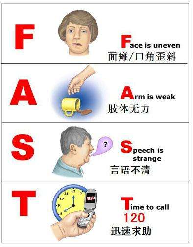 Fast英语单词发音指南